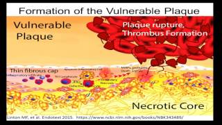 Macrophage Apoptosis and Efferocytosis in Atherosclerosis A Matter of Life and Death [upl. by Chuipek28]