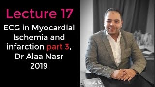 ECG from A to Z 017Alaa nasr2019 Myocardial ischemia part 3 [upl. by Mcloughlin]