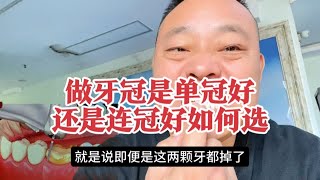 去医院做牙冠是做单冠还是连冠，该如何选，有哪些后顾之忧？ [upl. by Attenauq634]