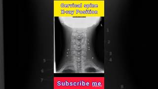 Cervical Spine Xray Position AP Lateral shorts viralmedical craft support me [upl. by Eire377]