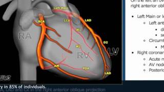 This Video Can Save Your Life Pt2 Catheter Angiogram Stentmov [upl. by Azile]