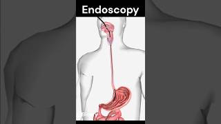 Endoscopy [upl. by Yborian]