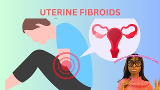 WHAT ARE FIBROIDS Epidemiologyanatomypathologysignstreatment and prevention fibroid health [upl. by Edgard]