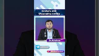 Crohns Disease vs Ulcerative Colitis  Quick Bites Internal Medicine Gastroenterology [upl. by Ajad]