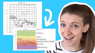 How to Read an Audiogram [upl. by Ilhsa]