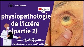 Physiopathologie de lictère  PARTIE 2  Ictère a bilirubine non conjugué [upl. by Dauf]