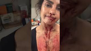 Priyanka Chopras got injured during shoot 🤯  Nettisan360 [upl. by Bergmans]