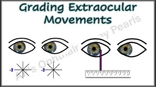 Grading Extraocular Movements [upl. by Lielos]