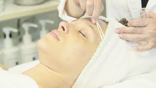 How To Treat OnGoing Brown Blotchy Melasma [upl. by Delamare186]