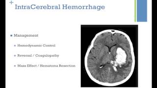 Neurological Critical Care Year in Review  Vishal Patel MD [upl. by Bebe]