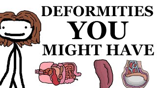 Deformities That You Might Have [upl. by Domenico]