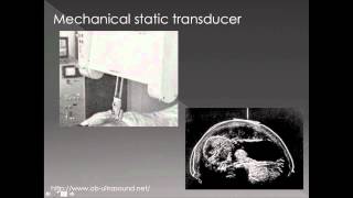 Ultrasound Physics 3  Beam Formation and Transducers [upl. by Rihsab]