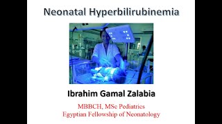 New guidelines for treatment of neonatal hyperbilirubinemia [upl. by Eduam396]