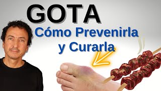 La Verdad Sobre la Gota Cómo Prevenirla y Curarla [upl. by Avert722]