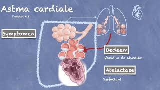 Protocol 63 Astma Cardiale Landelijk Protocol Ambulancezorg [upl. by Netloc]
