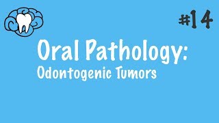 Oral Pathology  Odontogenic Tumors  INBDE ADAT [upl. by Lyrrehs737]