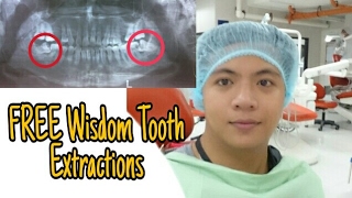 FREE Impacted Wisdom Teeth Removal amp Pain Reliever Tips [upl. by Nekcerb56]