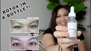 The Ordinary Argireline Solution 30 Day Trial  Before amp After  Reduce Fine Lines and Wrinkles [upl. by Scotty]