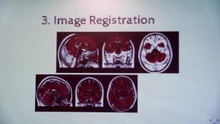 Data Analysis in MRI and PETMRI Neuroimaging  Davide Poggiali [upl. by Nalod]