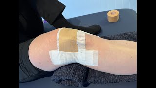 Knee  Patella Taping [upl. by Zoba447]