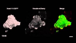 Cadherin11 localizes to focal adhesions and promotes cell–substrate adhesion [upl. by Enneire]