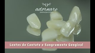 Lentes de Contato Dental e Sangramento Gengival O que fazer [upl. by Edi]