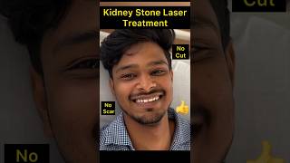 Laser Kidney stone treatment  RIRS  Retrograde Intrarenal Surgery  Kidney Stone treatment  rirs [upl. by Mast]