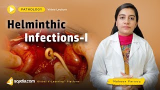 Helminthic Infections  Pathology Course  Medical Education  VLearning  sqadiacom [upl. by Goldshlag439]