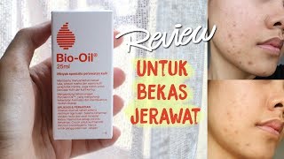 Mini Review BioOil ChitChat ENG SUBS [upl. by Alyahsal347]