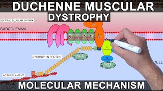 Duchenne Muscular Dystrophy [upl. by Rekyr]