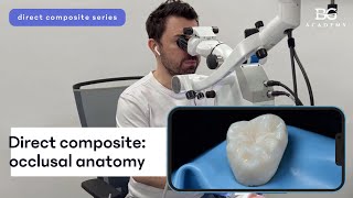 Direct composite occlusal anatomy [upl. by Inglebert]