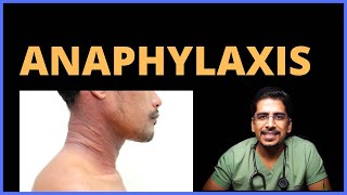 Anaphylaxis Causes Clinical features Management [upl. by Attaymik]