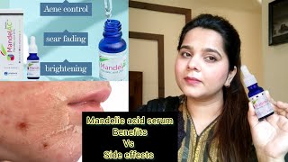 How to use Mandelic acid serum  mandelic acid serum review [upl. by Olrac]