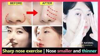 💉 tipplasty  bulbous nose tip reduction [upl. by Vivienne373]