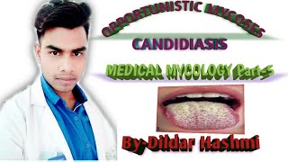 Candidiasis Opportunistic Mycoses [upl. by Nylasej]