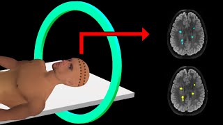 PET Scan  How It Works  Animation [upl. by Sadoc]