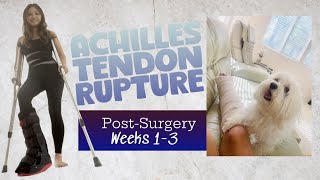 ⚠️ Complete Rupture of Achilles TendonPostSurgery Weeks 13 [upl. by Jobie]