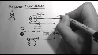 Reflexes 2  Pupillary Light Reflex [upl. by Aara]