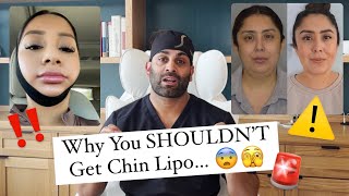 5 Reasons Why You SHOULDNT Get Chin Lipo [upl. by Myrwyn894]