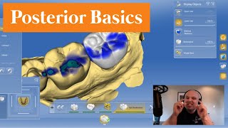 CEREC Stuff How To DESIGN AND FINISH A Single Unit Posterior  Back To The Basics [upl. by Proudlove]