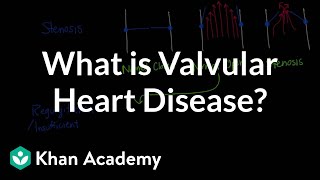 What is valvular heart disease  Circulatory System and Disease  NCLEXRN  Khan Academy [upl. by Ribaj]