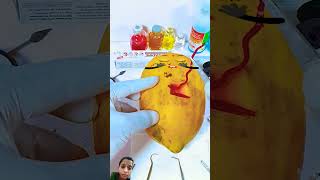 Food surgery satisfying funny fruit mukbang animation [upl. by Harday444]