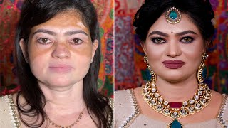 Vitiligo makeup for bridal look [upl. by Bernardine]