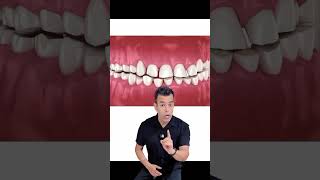 Is Your Daily Stress Causing You to Grind Your Teeth at Night [upl. by Farrington]