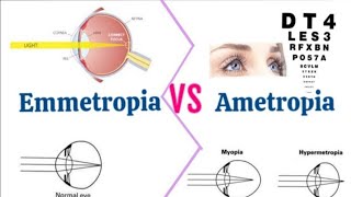 What Is EmmetropiaEmmetropiya kya hai What Is Ametropia In Hindi [upl. by Siul586]