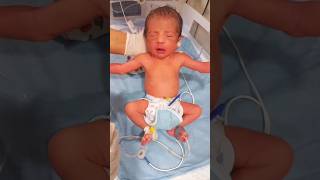 The moro reflex test❤️ newlyborn newbornbaby babycare shortvideo trendingshorts trendingreels [upl. by Ferdinana]