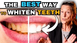 The BEST Way to Whiten Your Teeth without ruining them [upl. by Hannahsohs337]