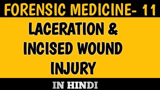 Laceration amp Incised wound in forensic medicine  FMT chapter 11 part 4 [upl. by Grider]