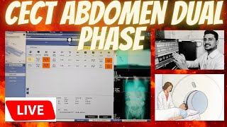 CECT Abdomen dual phase live scan  CT abdomen pelvis scanning technique radiologytechnologist [upl. by Ynomrah]