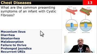 internalmedicine cme usmle محاضراتباطنة ecg كورساتباطنة clinical clinical medicine [upl. by Janka711]